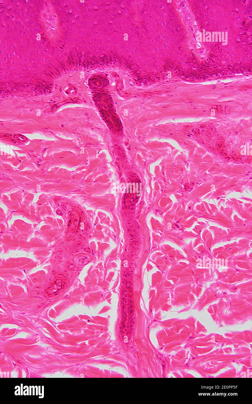 Human skin showing epidermis and dermis with sweat glands and connective tissue. X125 at 10 cm high. Stock Photo