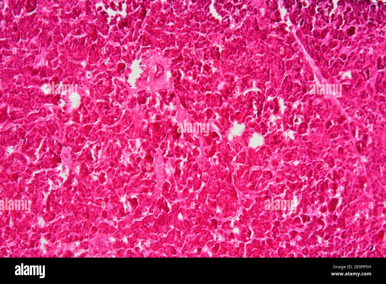 Human pancreas is an endocrine and exocrine organ. X75 at 10 cm wide. Stock Photo