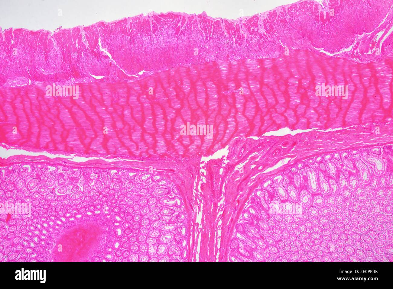 Human large intestine (colon) showing from top to bottom: muscular layers, submucosa and mucosa with Lieberkhun crypts. X25 at 10 cm wide. Stock Photo
