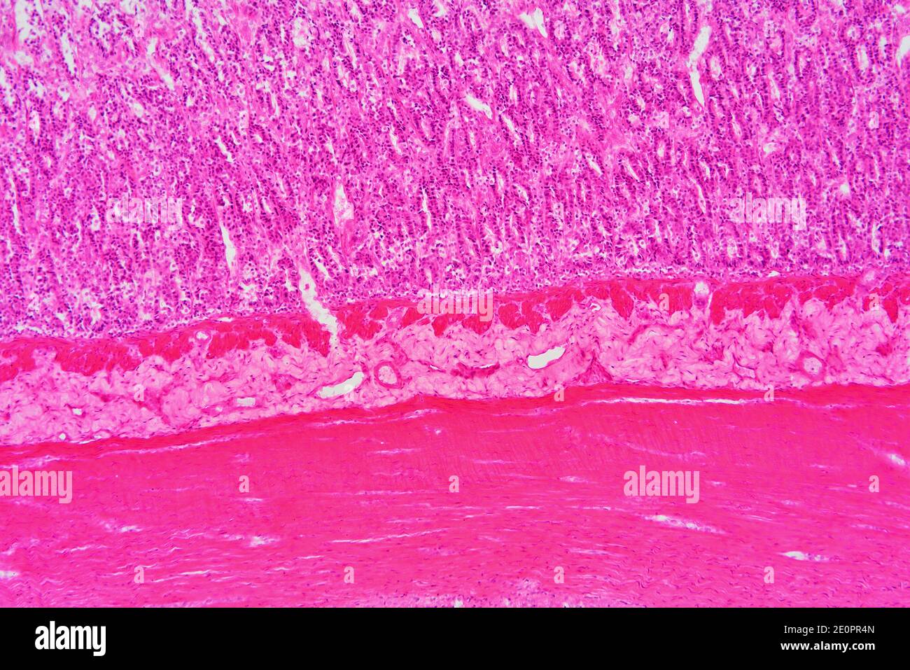 Human small intestine (duodenum) showing from bottom to top: muscular fibers, submucosa and mucosa with Lieberkhun crypts. X75 at 10 cm wide. Stock Photo