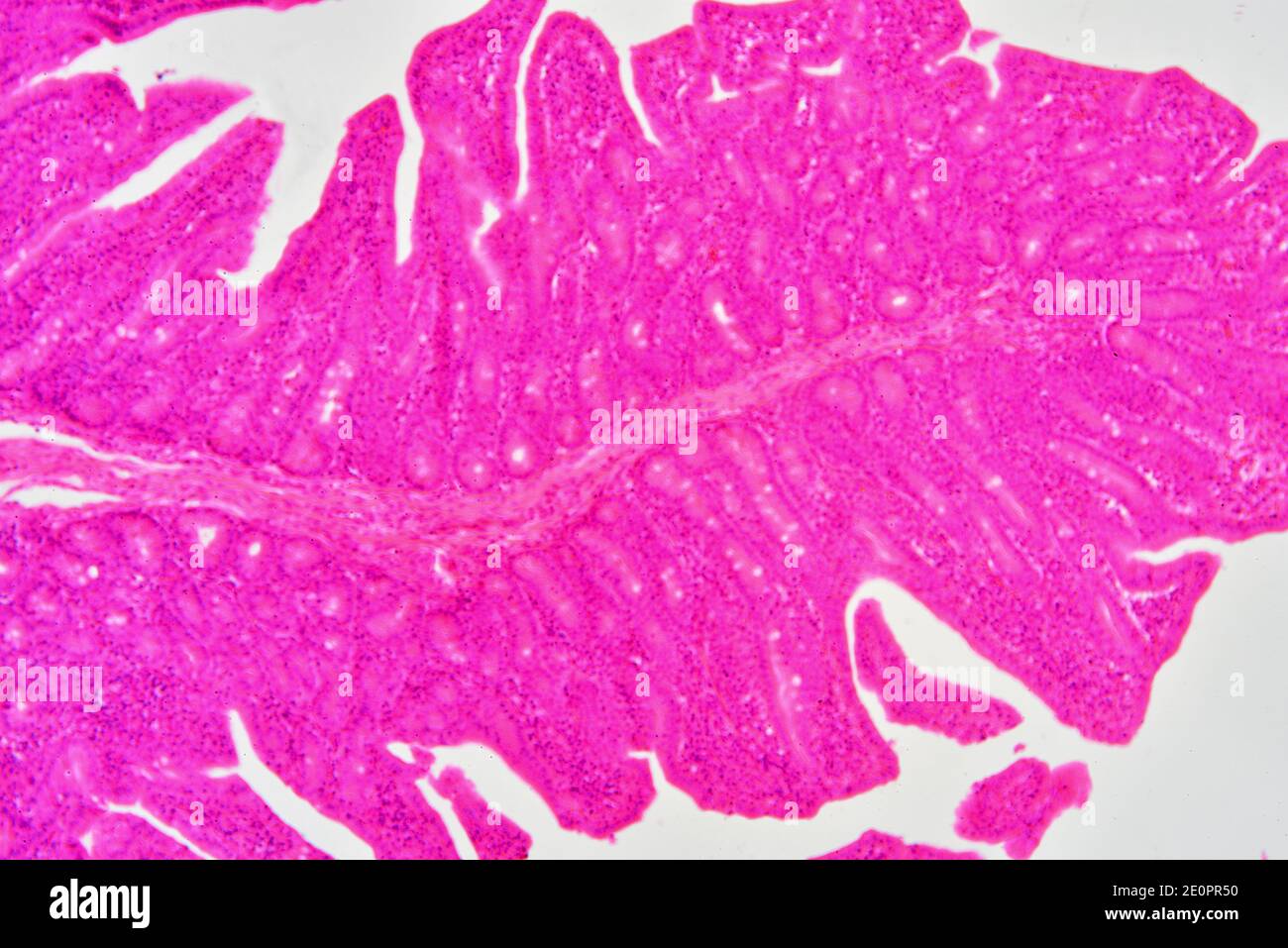 Human small intestine (jejunum) showing mucosa with Lieberkhun crypts. X75 at 10 cm wide. Stock Photo