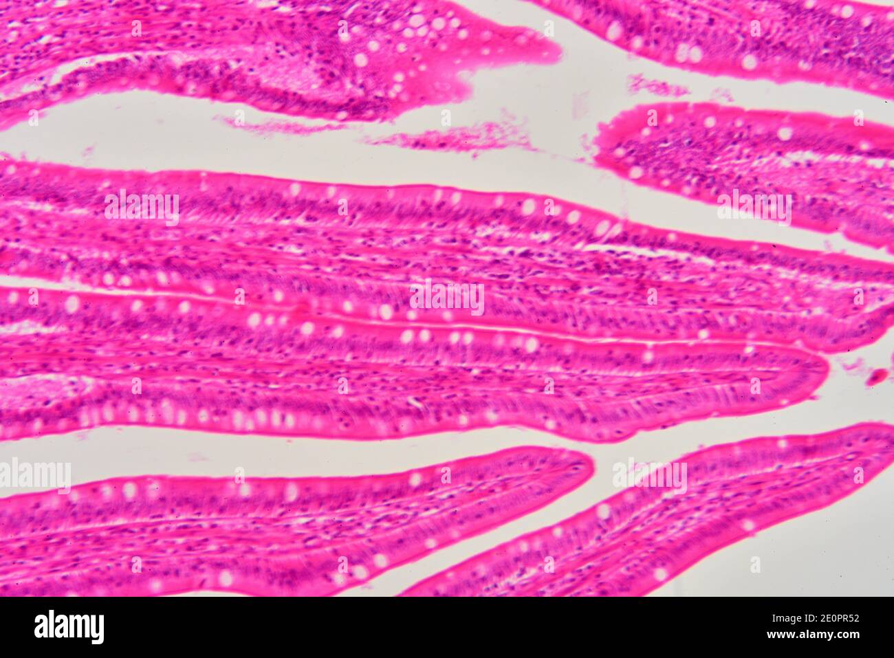Human small intestine showing mucosa with Lieberkhun crypts. X125 at 10 cm wide. Stock Photo