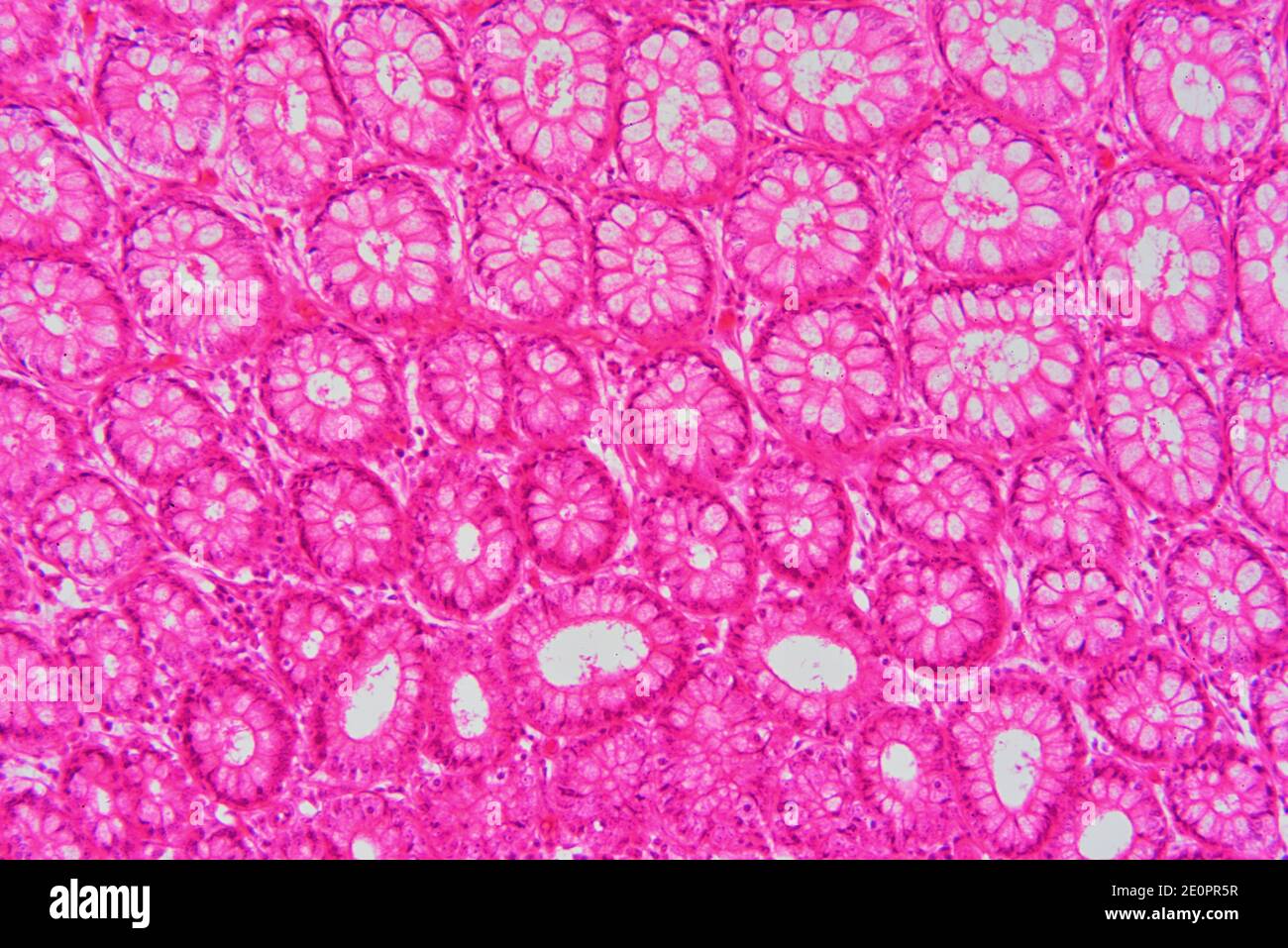 Human large intestine (colon) showing mucosa with Lieberkhun crypts. X125 at 10 cm wide. Stock Photo
