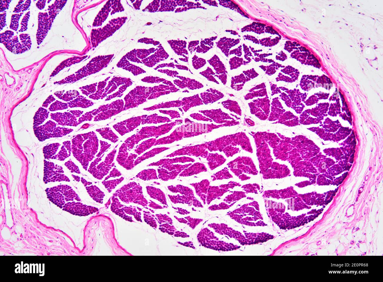 Human nerve fibers with perineurium. X75 at 10 cm wide. Stock Photo