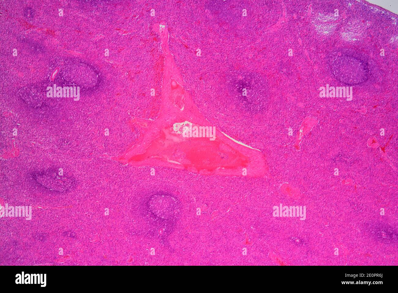 Human spleen (lymphatic organ) showing capsules, red pulp, white pulp and blood vessel. X25 at 10 cm wide. Stock Photo