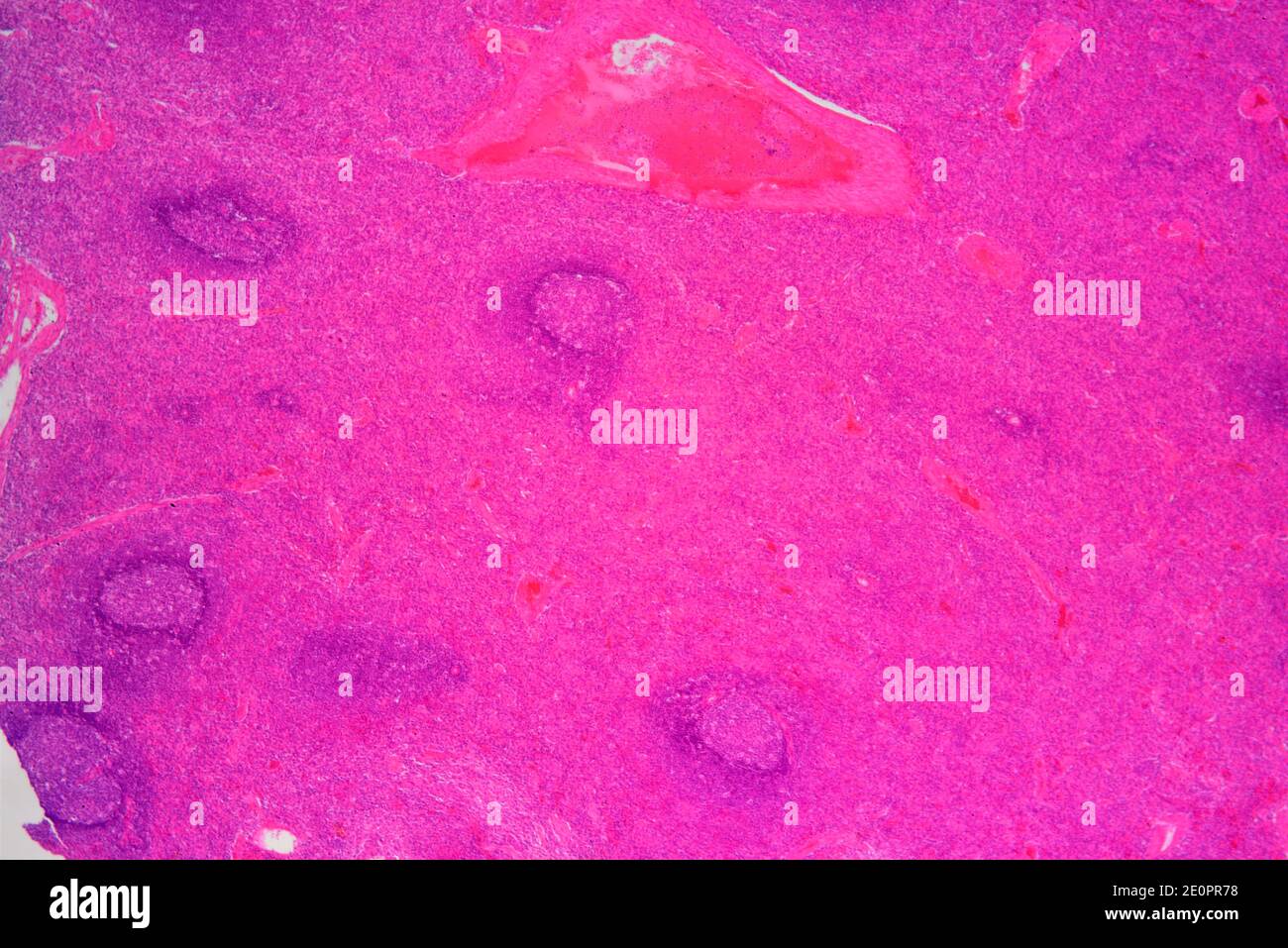Human spleen (lymphatic organ) showing capsules, red pulp, white pulp and blood vessel. X25 at 10 cm wide. Stock Photo