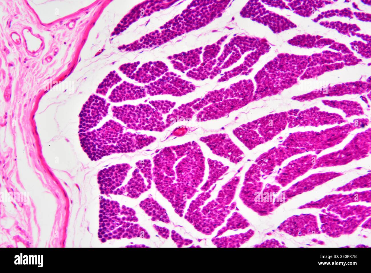 Human nerve fibers with perineurium. X125 at 10 cm wide. Stock Photo