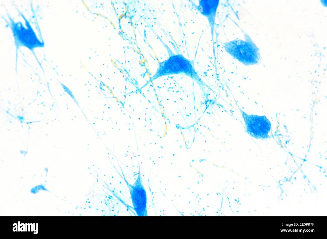 Human motor neurons. X75 at 10 cm wide. Stock Photo