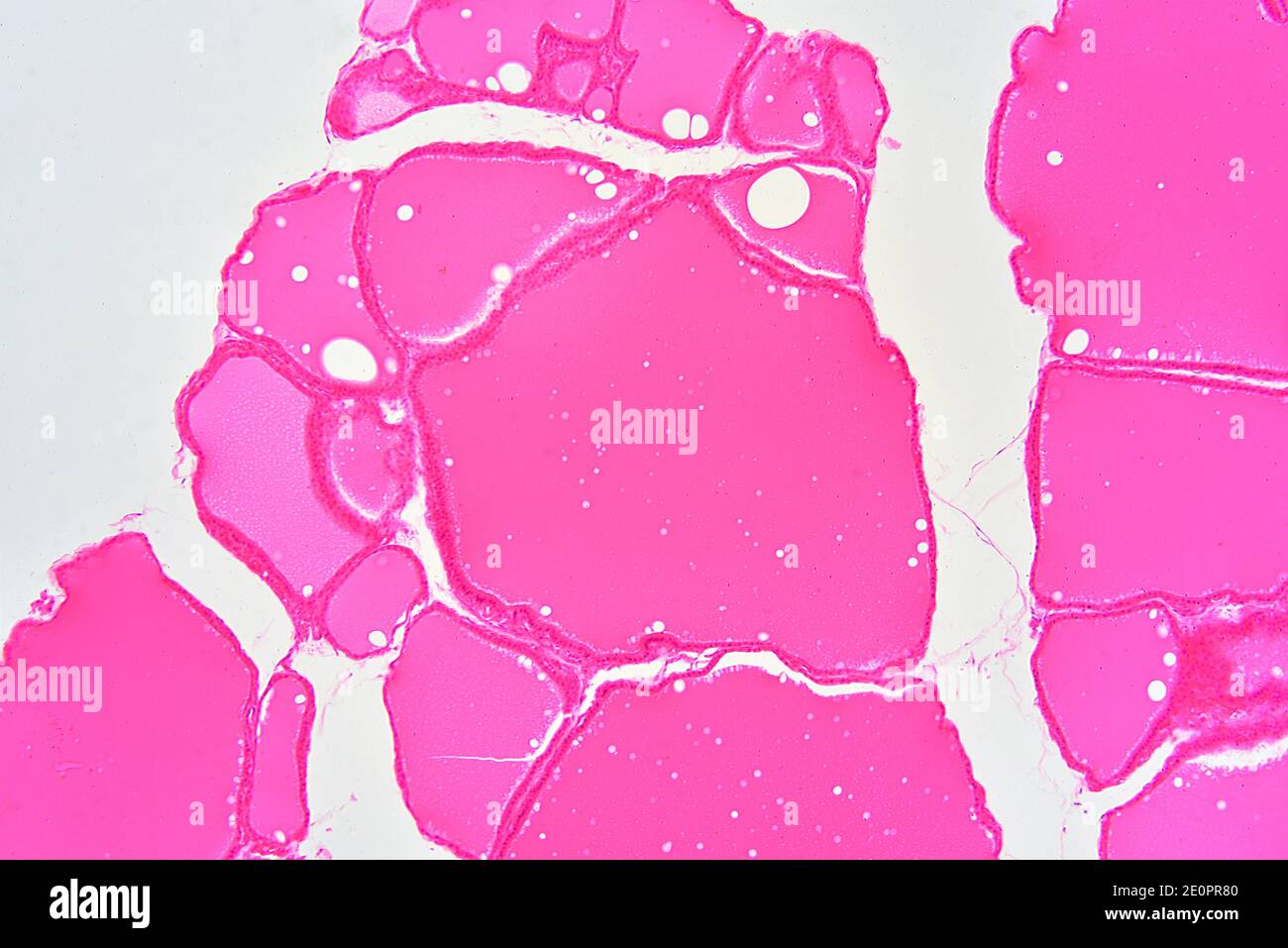 Human thyroid gland section showing colloid and follicular cells. X75