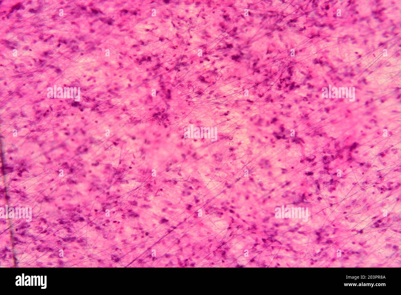 Human loose connective tissue with fibroblasts, collagen fibers and matrix. X75 at 10 cm wide. Stock Photo