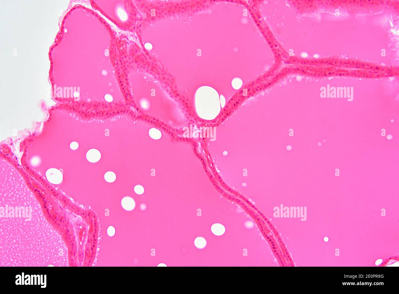 Human thyroid gland section showing colloid and follicular cells. X125