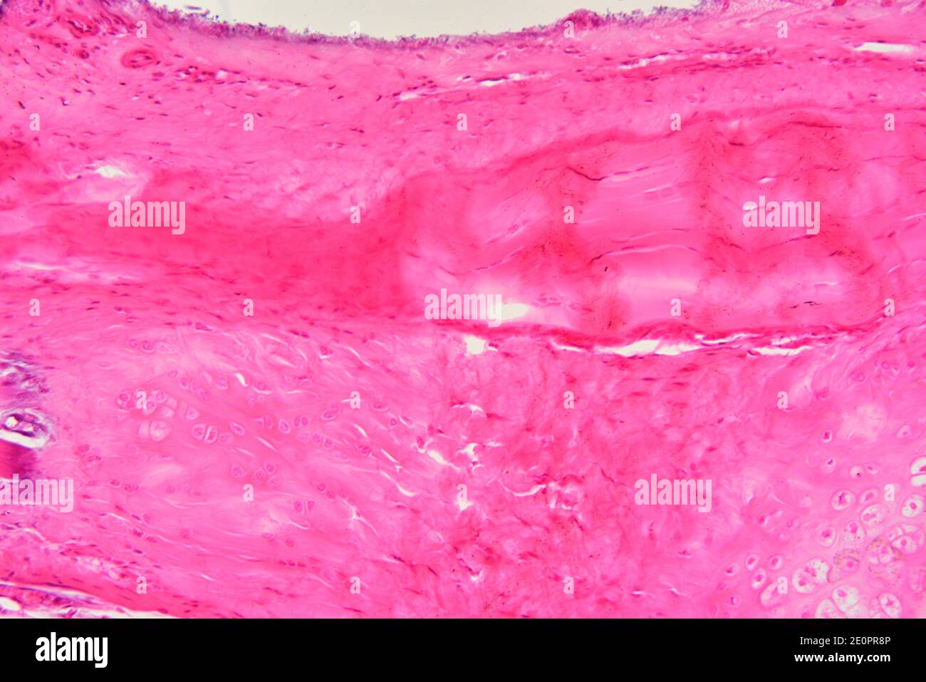 Human dense connective tissue. X125 at 10 cm wide. Stock Photo