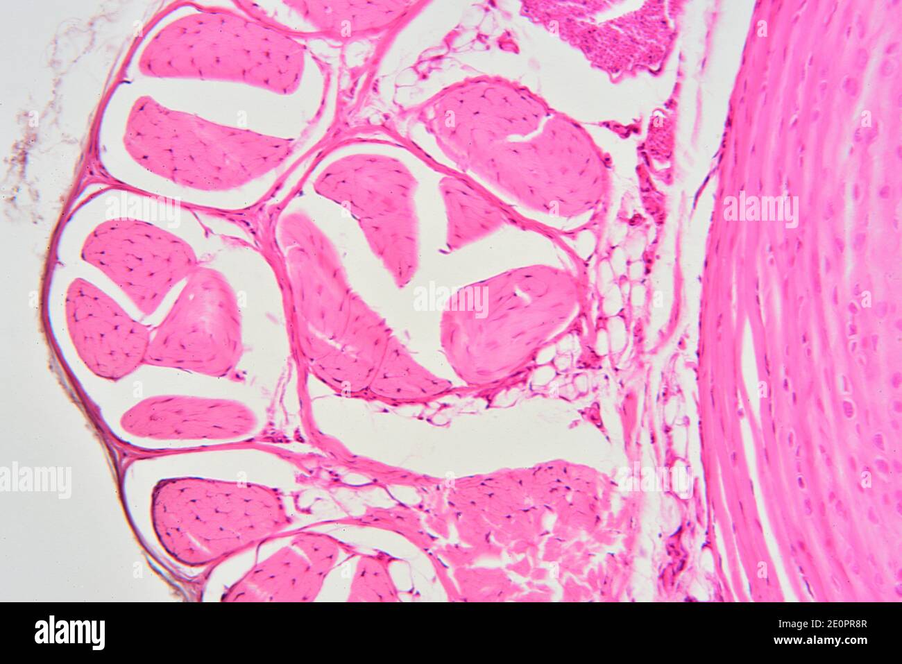 Human tendon. Tendon connect muscle to bone. X125 at 10 cm wide. Stock Photo