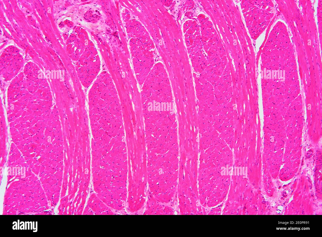 Tongue section with circular and longitudinal striated muscle fibers. X75 at 10 cm wide. Stock Photo