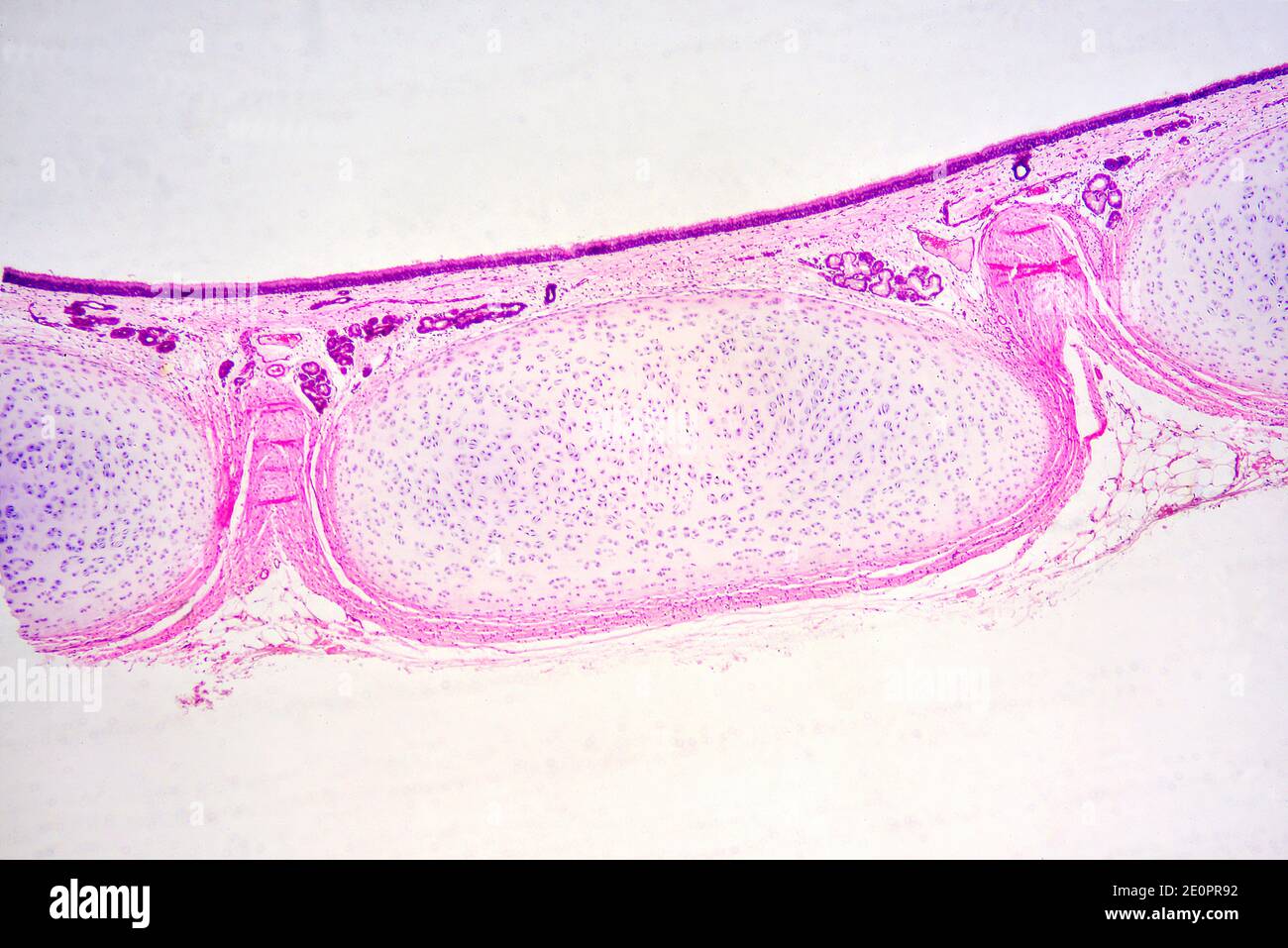 Human epiglottis section showing from up to down: respiratory epithelium, connective tissue, glands and elastic cartilage. X25 al 10 cm wide. Stock Photo