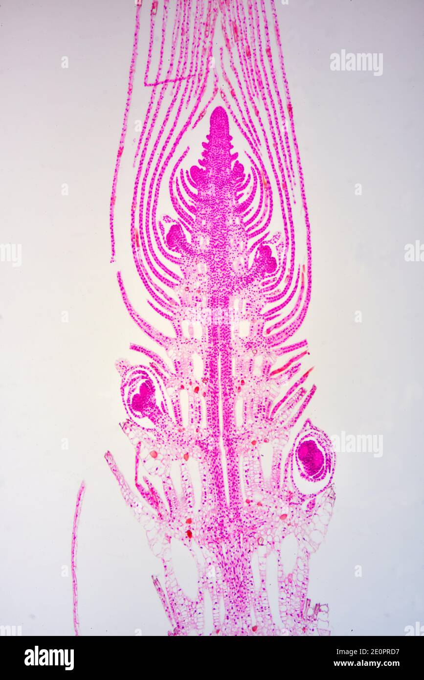 Apical meristem of Elodea canadensis. Photomicrograph X50 at 10 cm high. Stock Photo