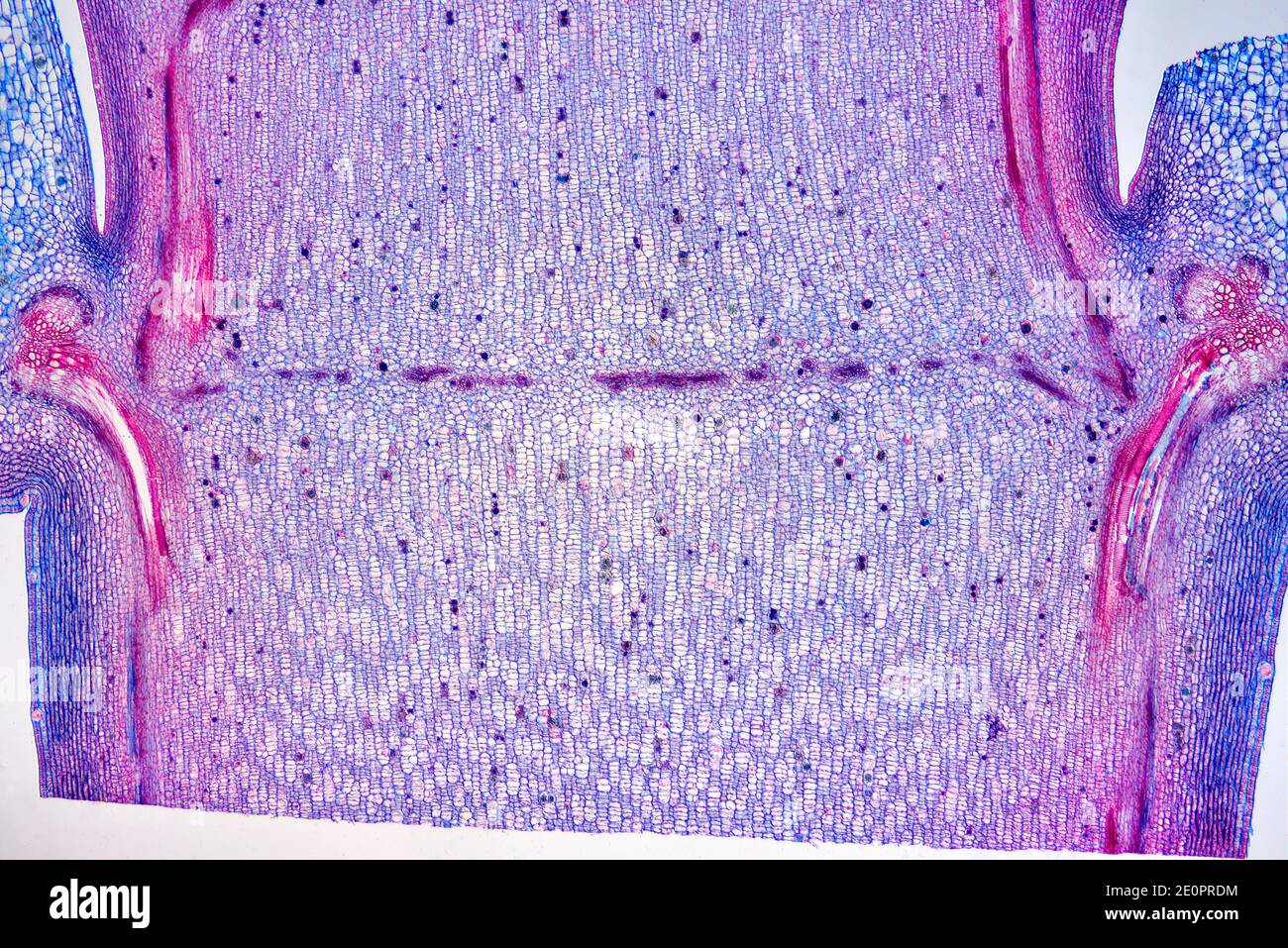Intercalary meristem. Photomicrograph X20 at 10 cm wide Stock Photo Alamy