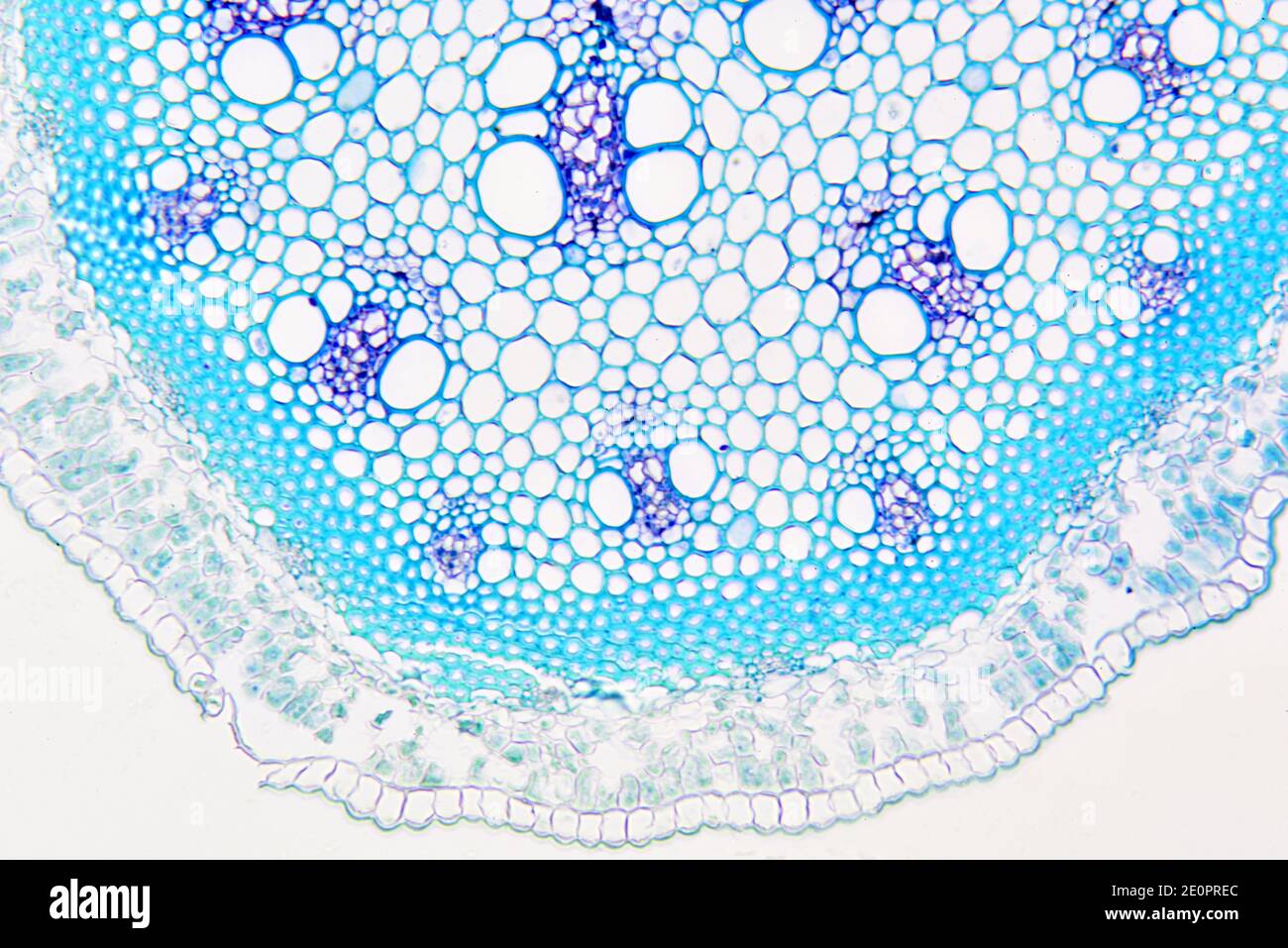 Stem of asparagus (Asparagus officinalis) showing from outside to inside: epidermis, cortex with palisade, endodermis, perycicle, vascular bundles Stock Photo