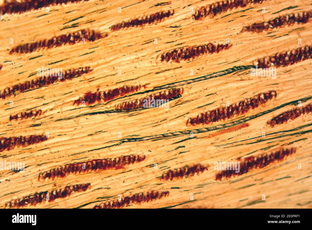Xylem parenchyma or woody parenchyma. Photomicrograph X100 at 10 cm wide. Stock Photo