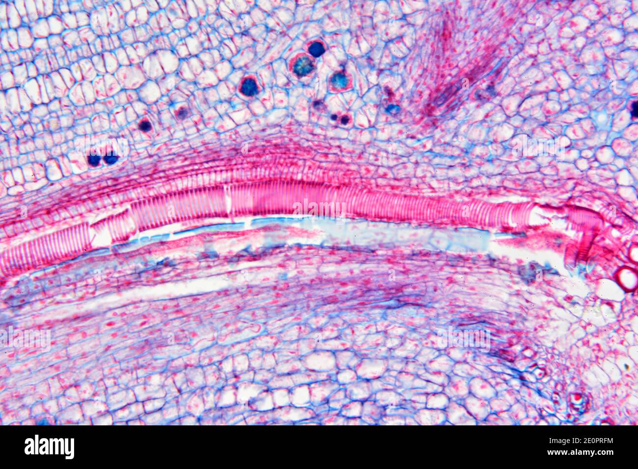 Vascular plant stem with spiral xylem. Photomicrograph X100 at 10 cm wide. Stock Photo