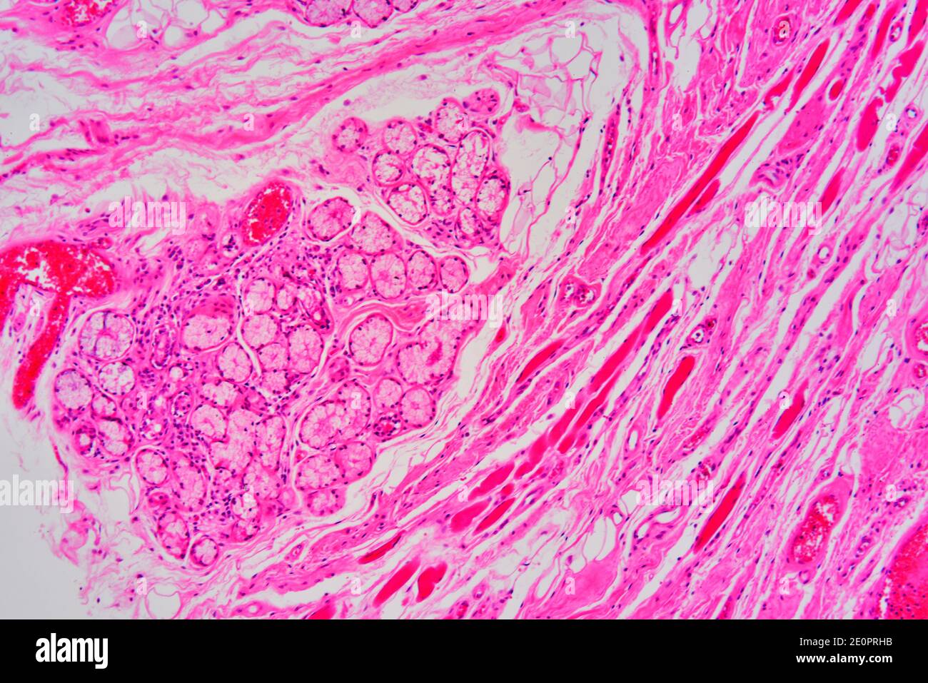 Parotid Gland High Resolution Stock Photography and Images Alamy