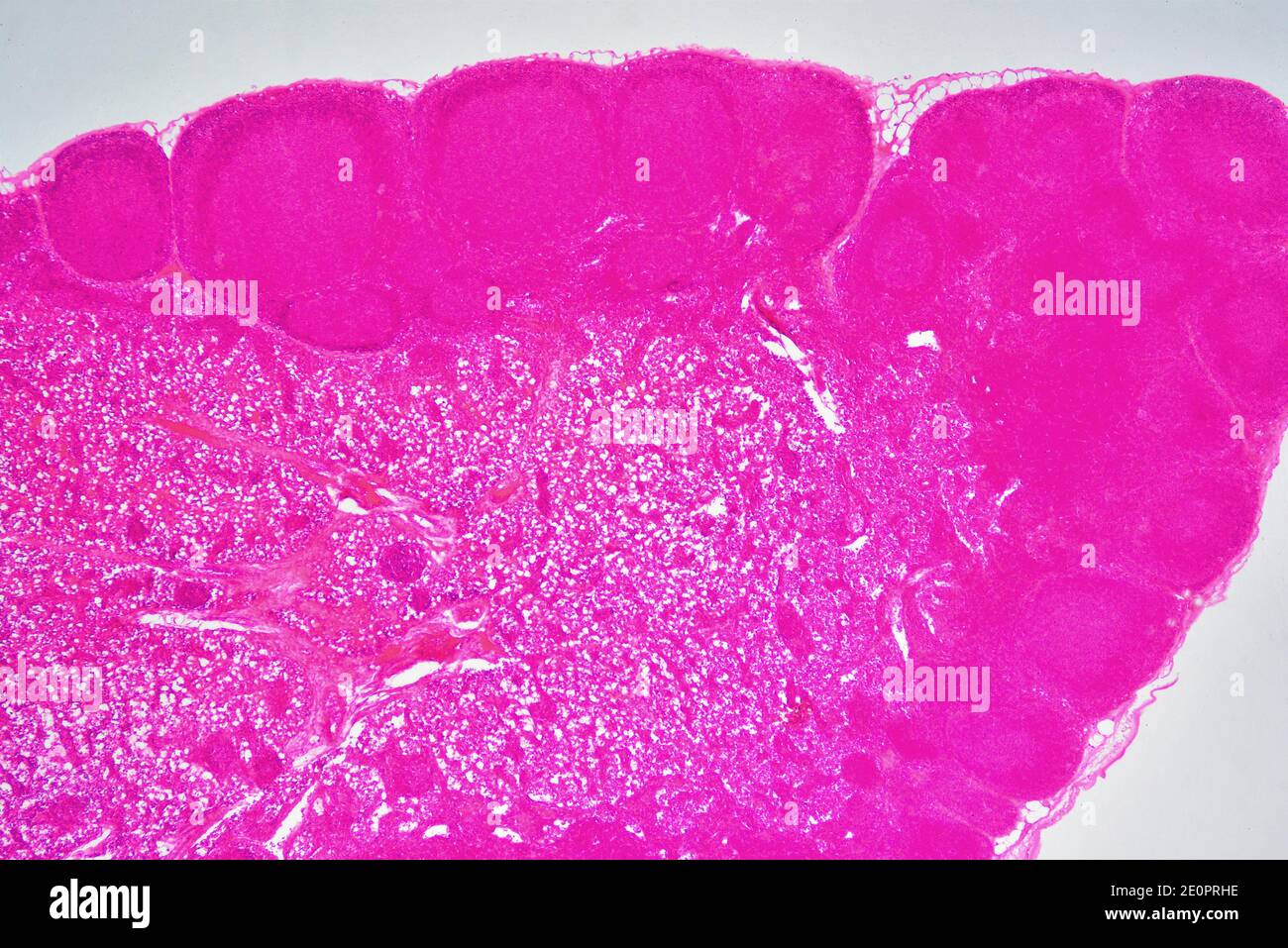 Lymph node or lymph gland with capsule, lymphoid nodule and trabeculae