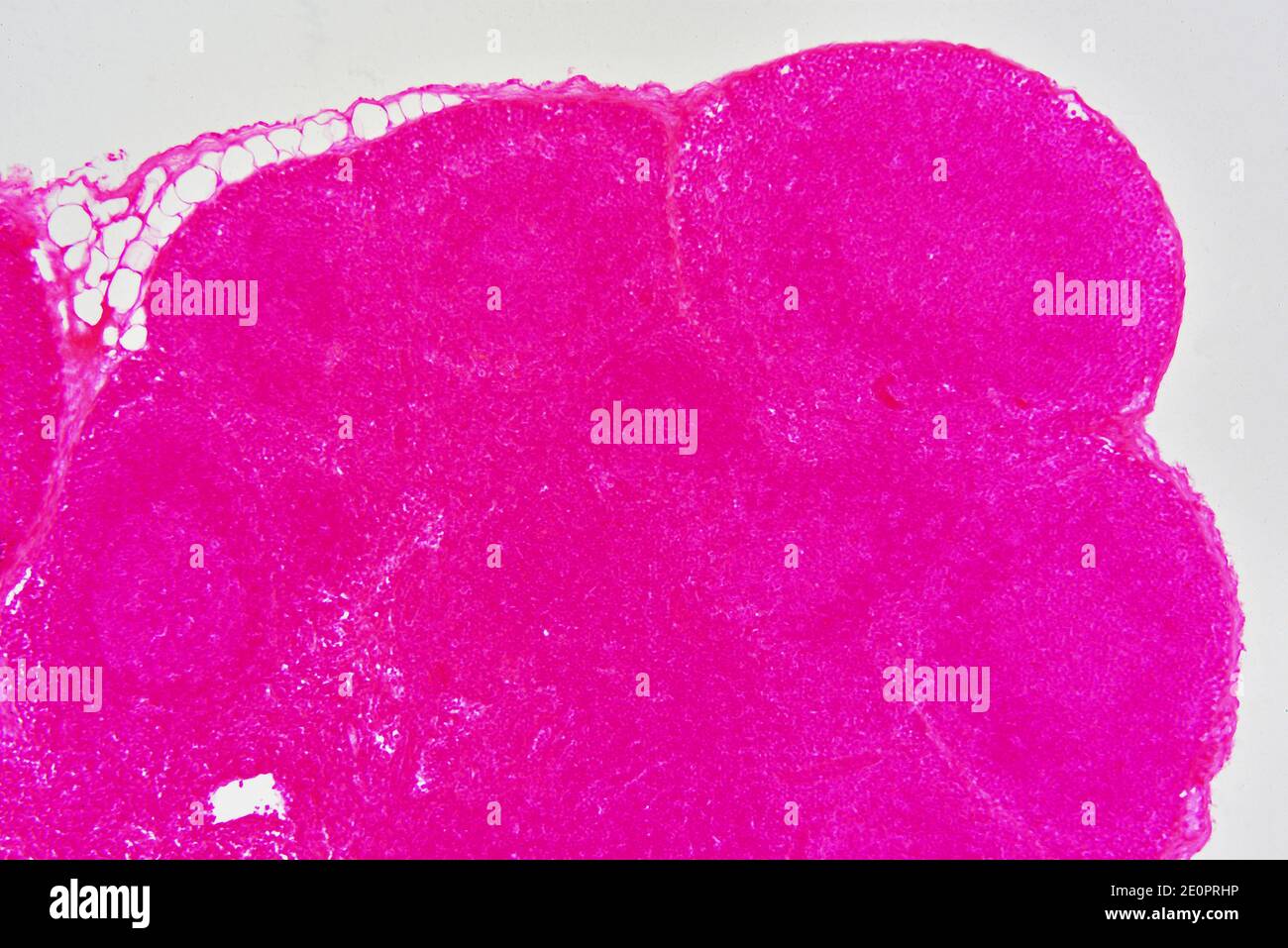 Lymph node or lymph gland with capsule, lymphoid nodule and trabeculae