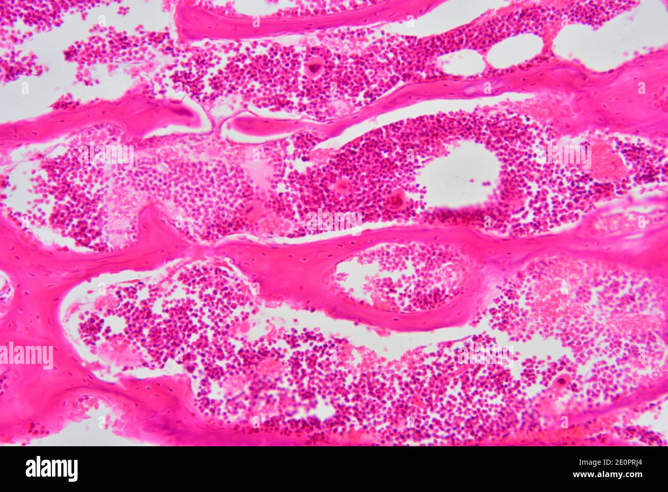 Histology Bone Marrow Hi res Stock Photography And Images Alamy