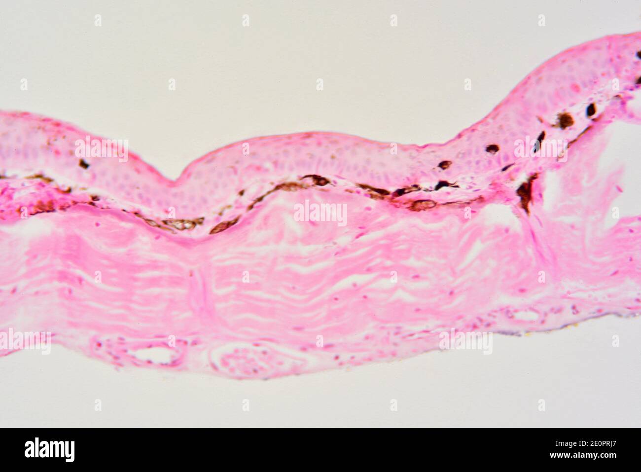 Frog skin showing epidermis, pigmentary layer with melanocytes (brown), blood vessels and dermis. Photomicrograph X150 at 10 cm wide. Stock Photo