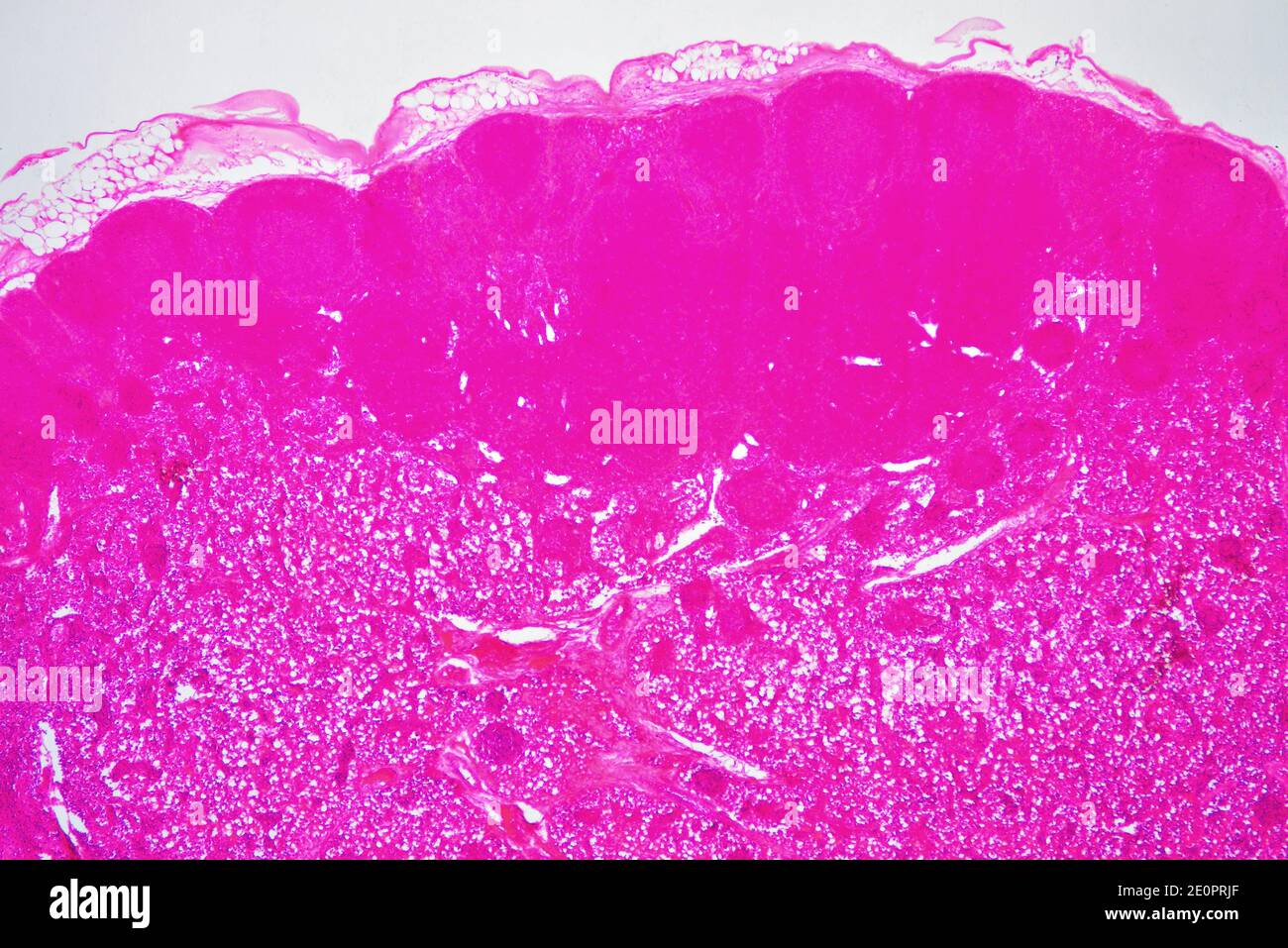 Lymph node or lymph gland with capsule, lymphoid nodule and trabeculae