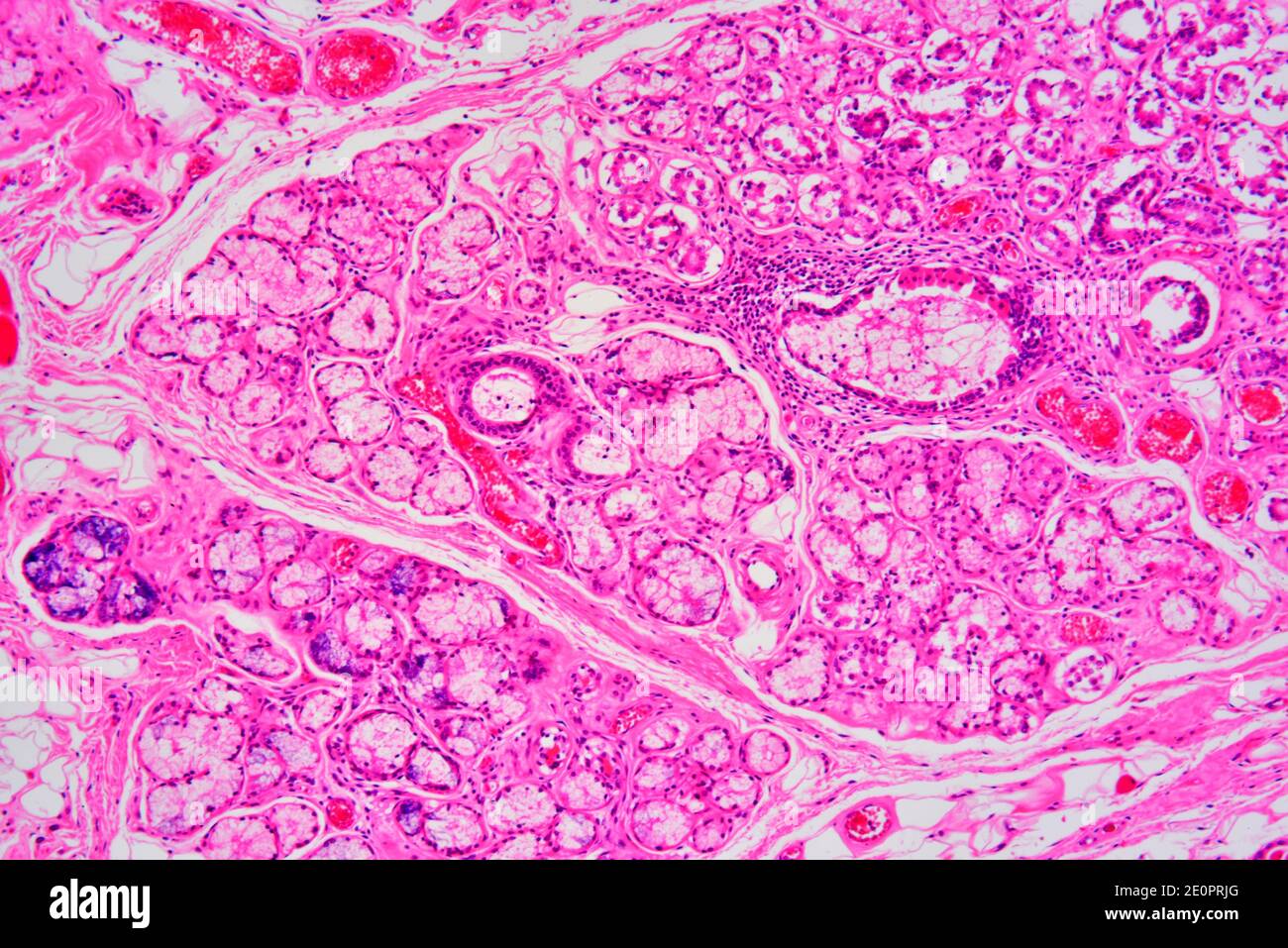 Parotid Gland Hi Res Stock Photography And Images Alamy