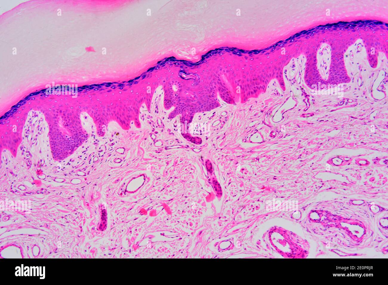Human skin with epidermis and dermis with sweat gland. Photomicrograph X75 at 10 cm wide. Stock Photo