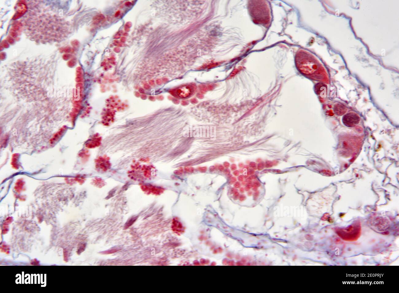 Ovotestis hires stock photography and images Alamy