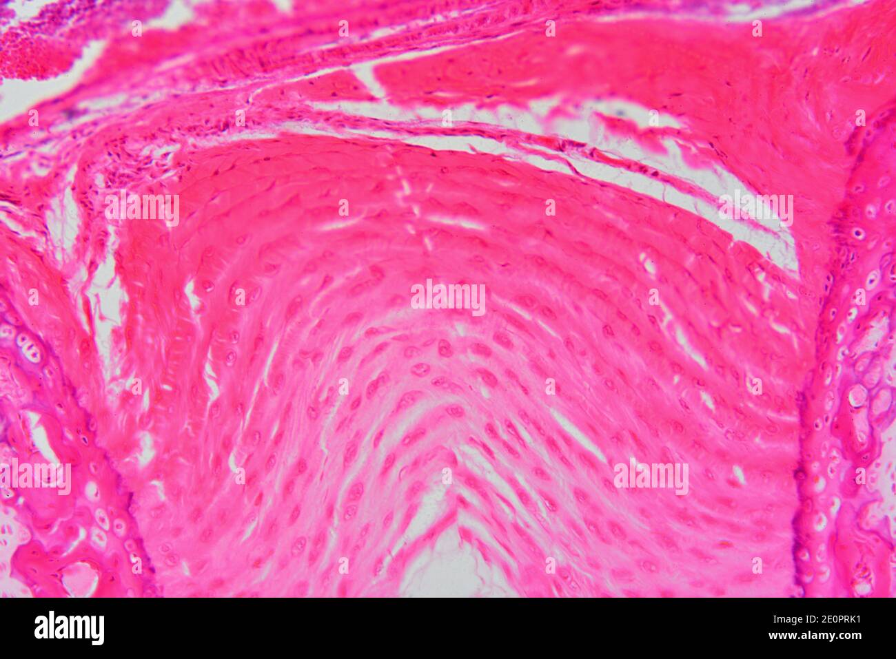 Fibrous connective tissue hires stock photography and images Alamy