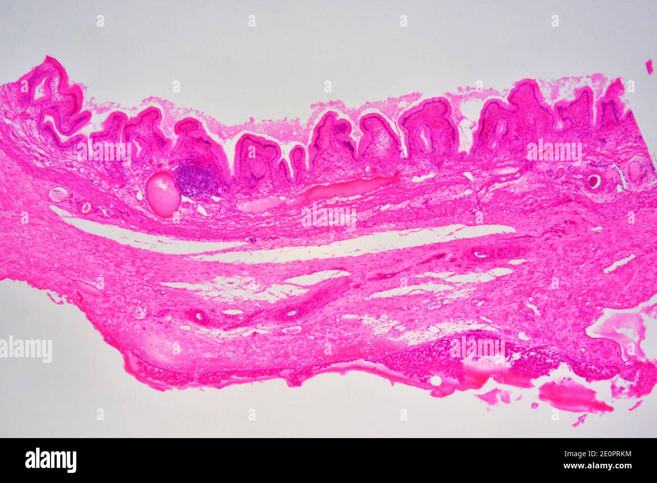 Simple Columnar Epithelium Gallbladder