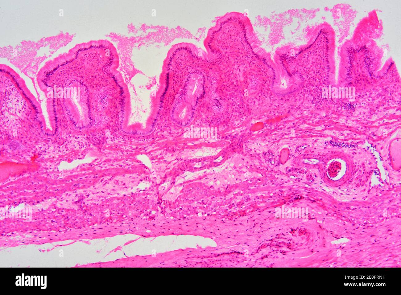 Gallbladder wall showing columnar epithelium with mucosal foldsi