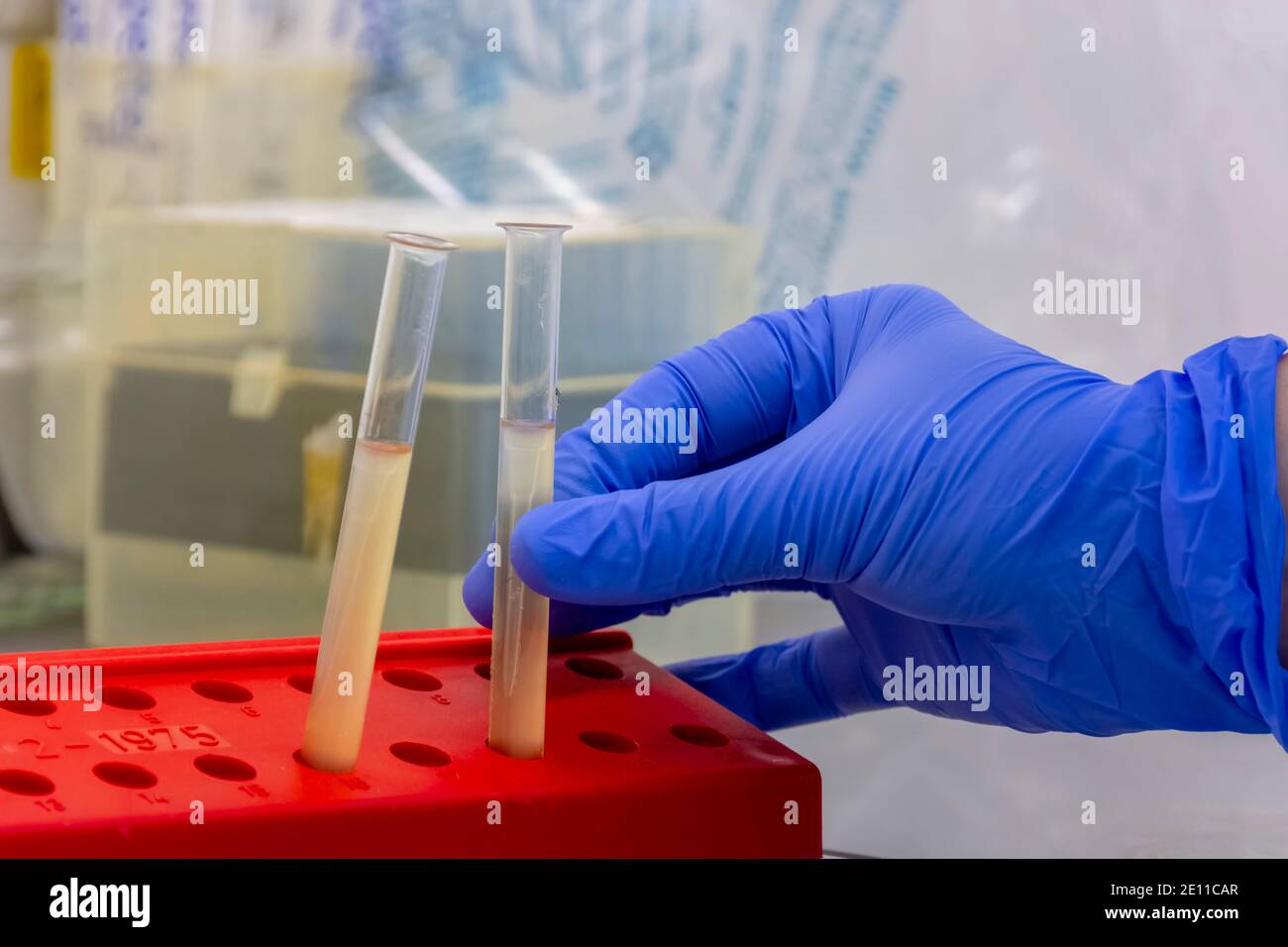 Scientist wearing gloves doing experiment with bacterial sample in the