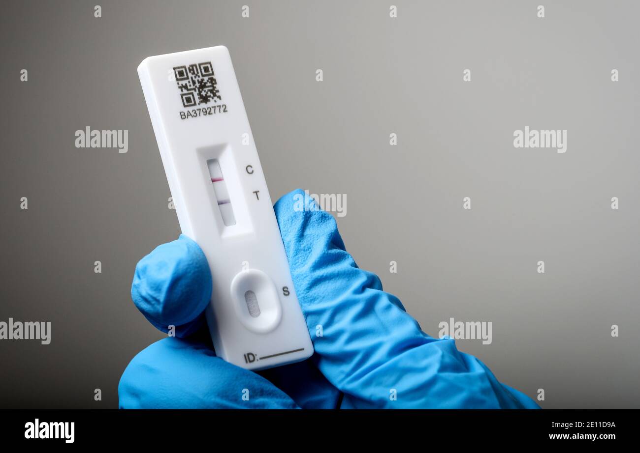 Coronavirus test using a Lateral Flow Device, the test shows a positive result, the patient has coronavirus. Stock Photo