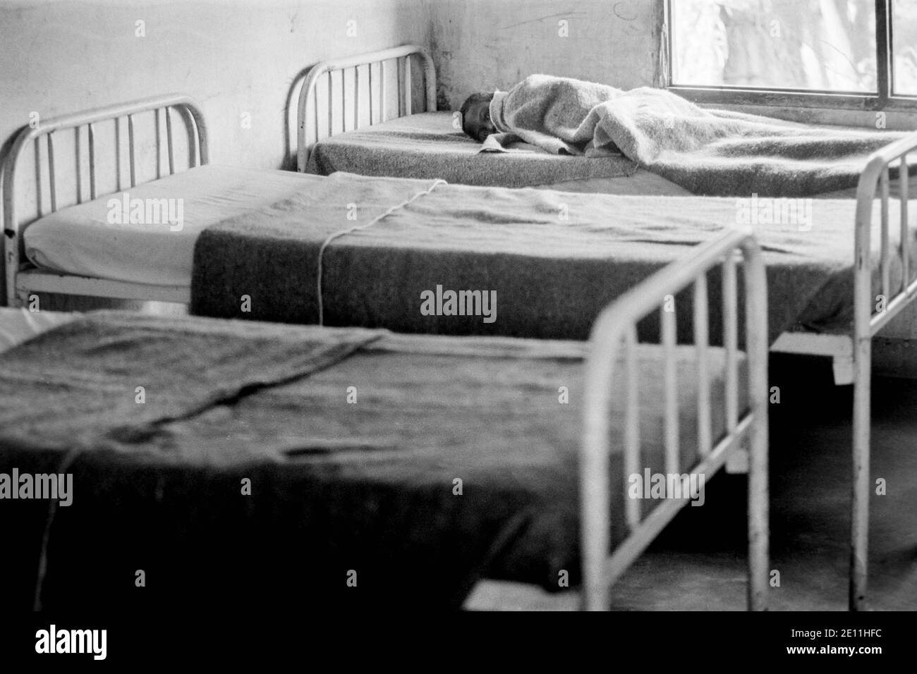 A young child patient with HIV /AIDS in a hospital in Malawi, Africa ...