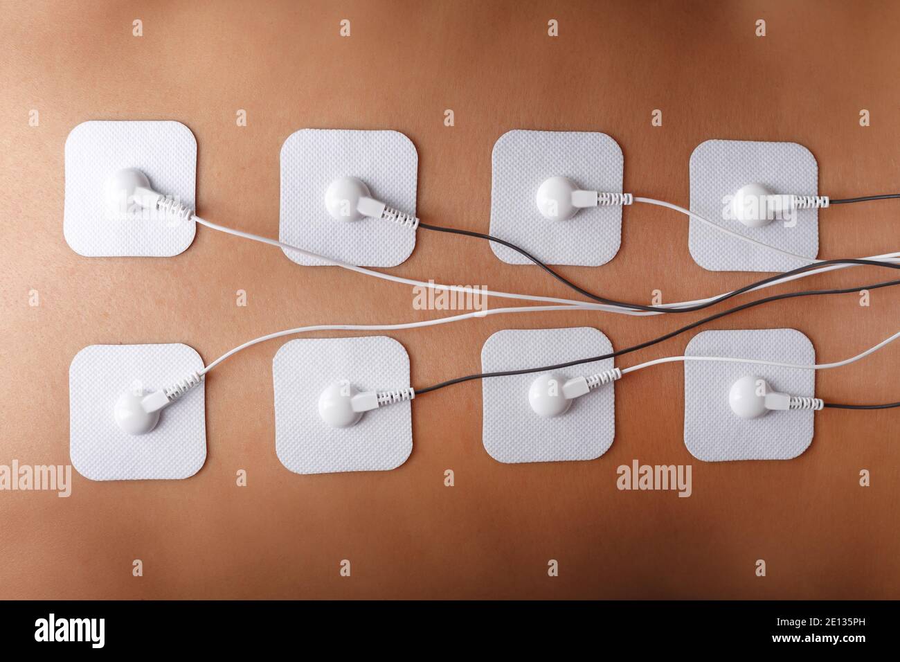 Electrode Stimulating massage of the spine at home. Medical procedure