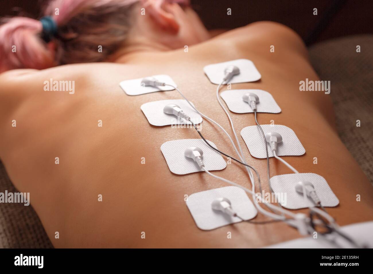 https://c8.alamy.com/comp/2E135RH/back-and-shoulder-massage-with-a-muscle-stimulator-with-attached-electrodes-along-the-spine-rehabilitation-and-treatment-weight-loss-2E135RH.jpg