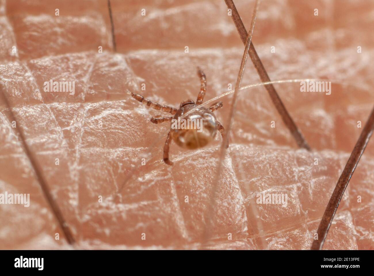 Tick larva on skin Stock Photo