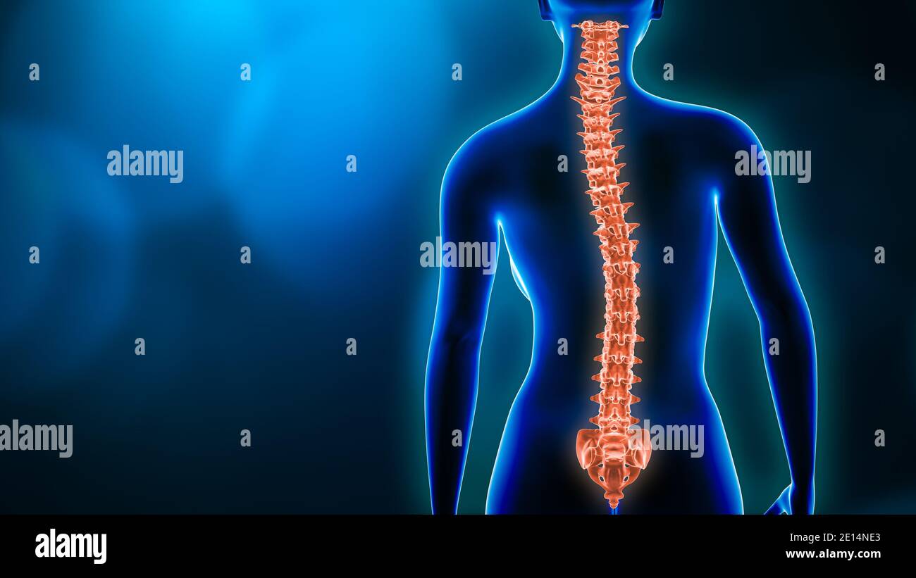 Curvature of the spine and woman body back view 3D rendering illustration with copy space. Spine disorder, scoliosis, backbone injury, human anatomy a Stock Photo