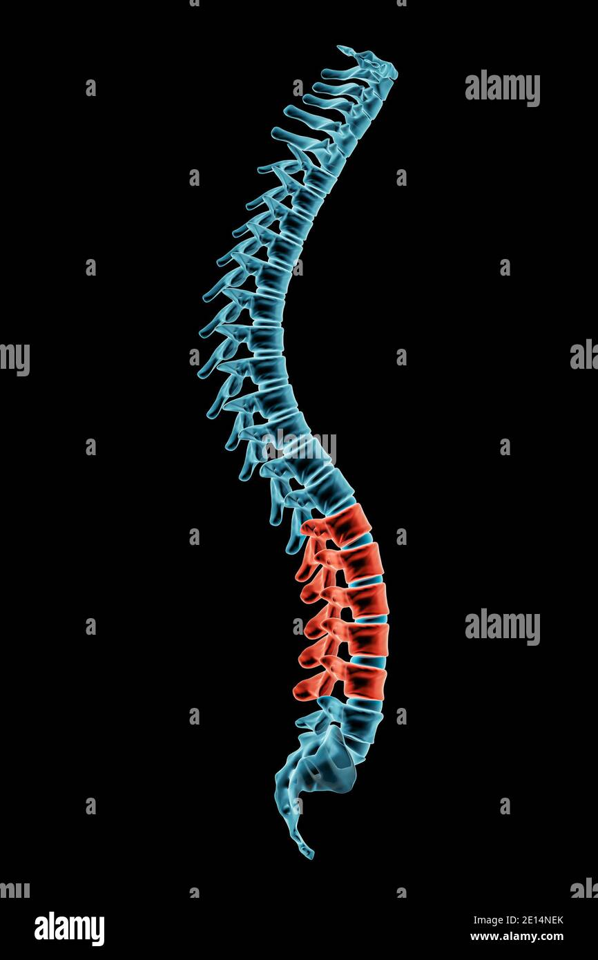 X-ray spinal column with lordosis posture and pathological vertebrae highlighted in red. Human curvature of the spine disorder 3D rendering illustrati Stock Photo