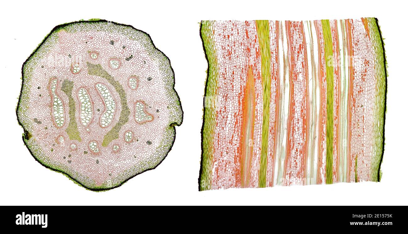 Bracken fern, Pteris aquilina, TS & LS.brightfield photomicrograph Stock Photo