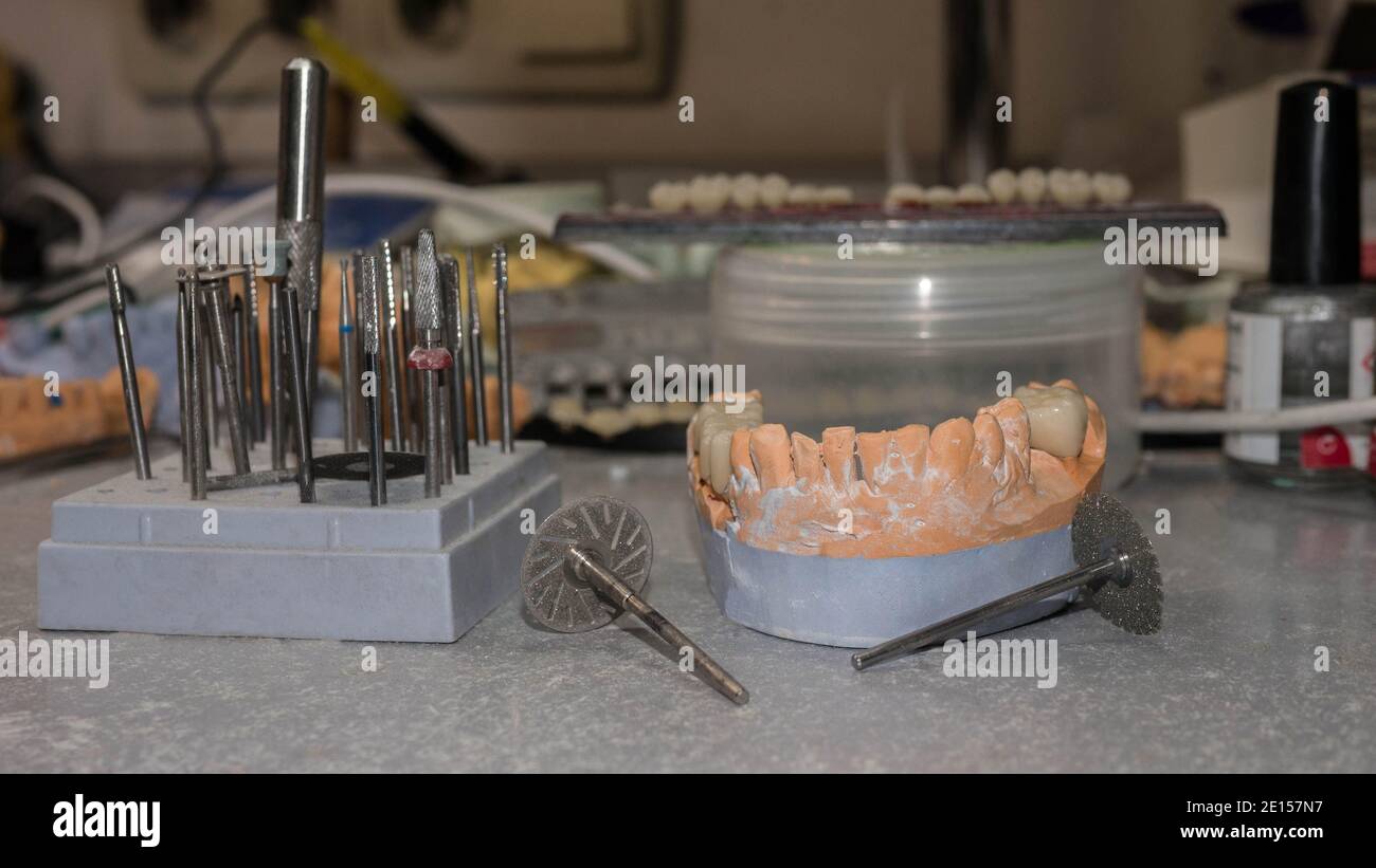 Ceramic crown of a tooth based on a plaster model of teeth, the work of
