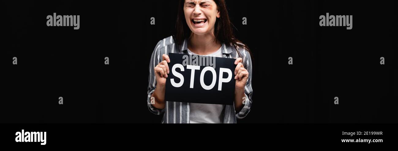 Crying woman with bruises holding card with stop lettering isolated on ...