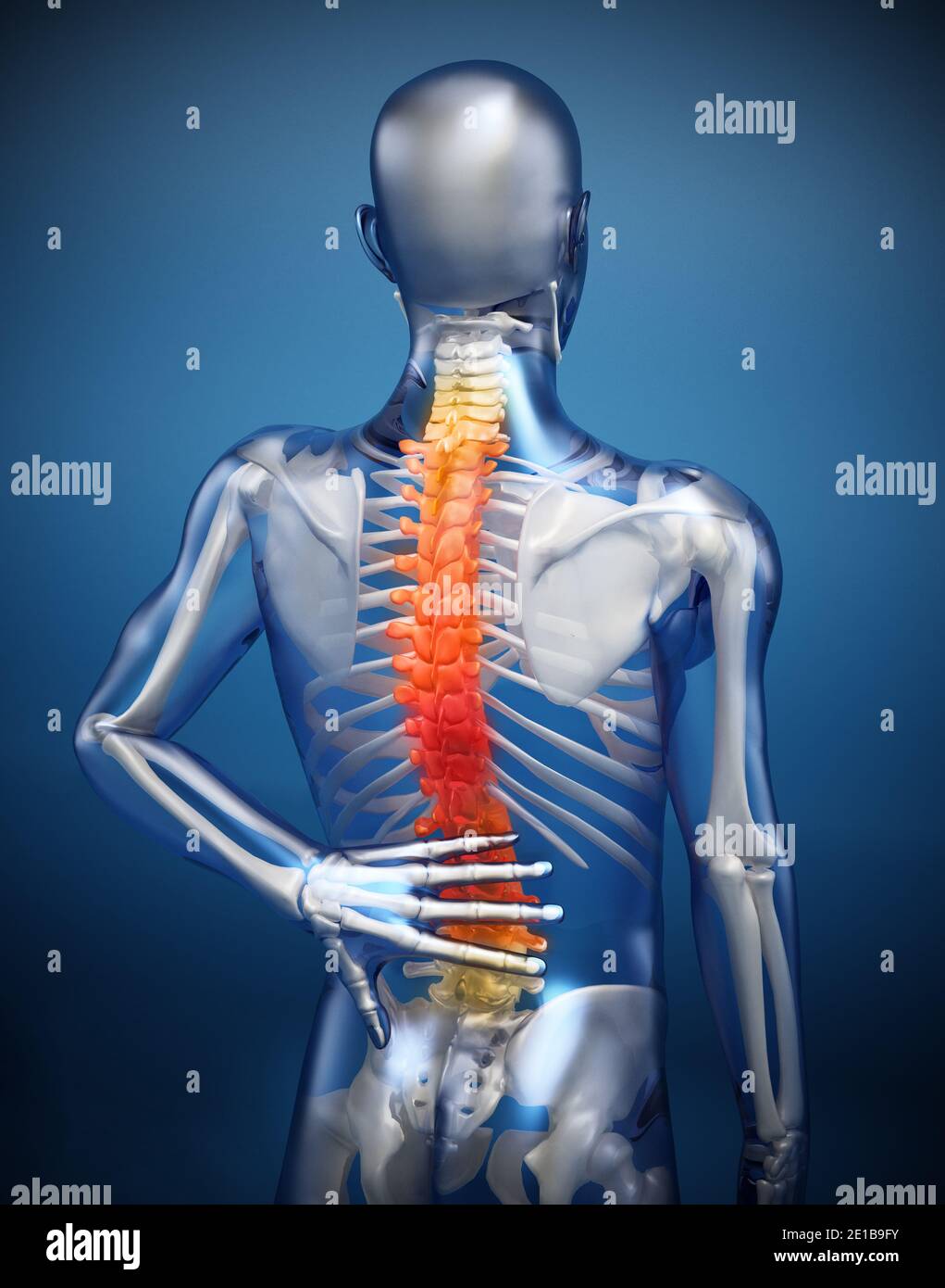 3D illustration showing back pain or pain on the spine Stock Photo - Alamy