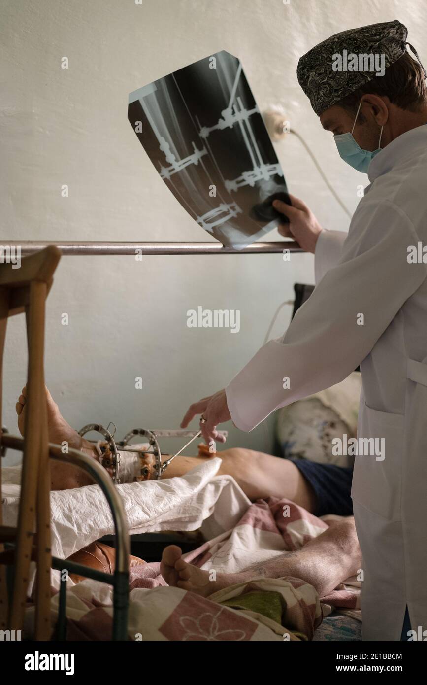 Male doctor checking on patient with Ilizarov apparatus fixation after orthopedic surgery holds x-ray. Limb-sparing technique treat complex open bone Stock Photo