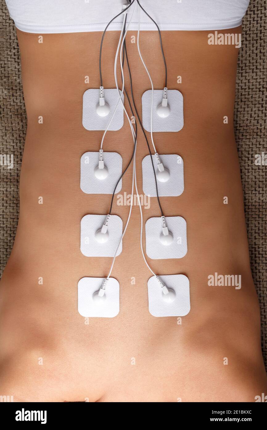 https://c8.alamy.com/comp/2E1BKXC/back-and-shoulder-massage-with-a-muscle-stimulator-with-attached-electrodes-along-the-spine-rehabilitation-and-treatment-weight-loss-2E1BKXC.jpg